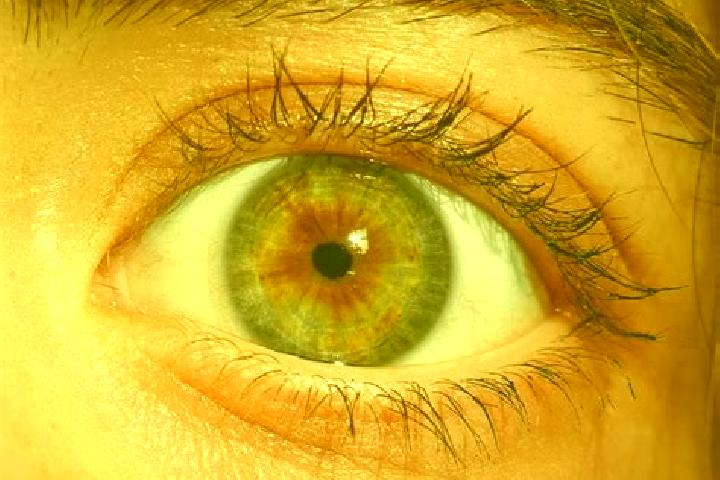 Mental 2 online slot